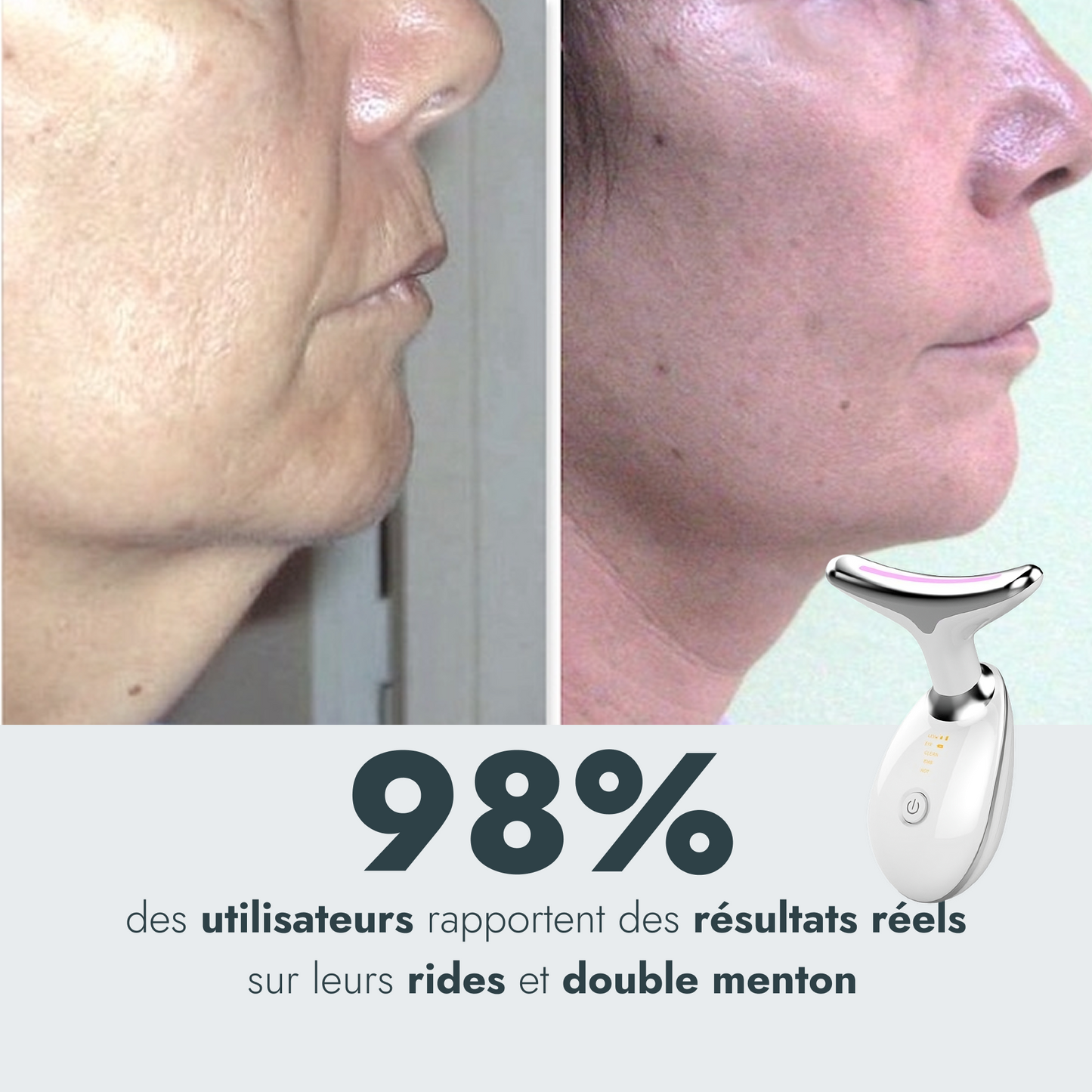Appareil EMS - Rajeunissement Facial et du Cou