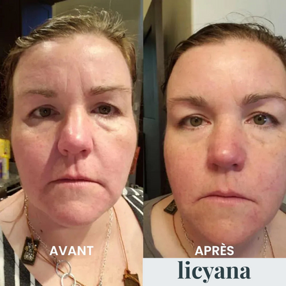 Crème Anti Cernes et Rides Instantanée