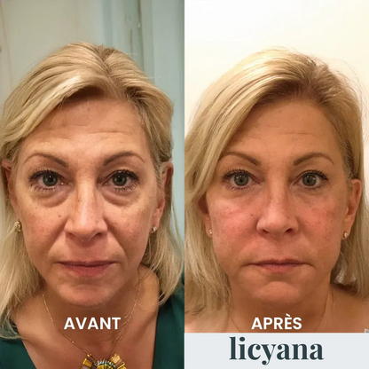 Crème Anti Cernes et Rides Instantanée