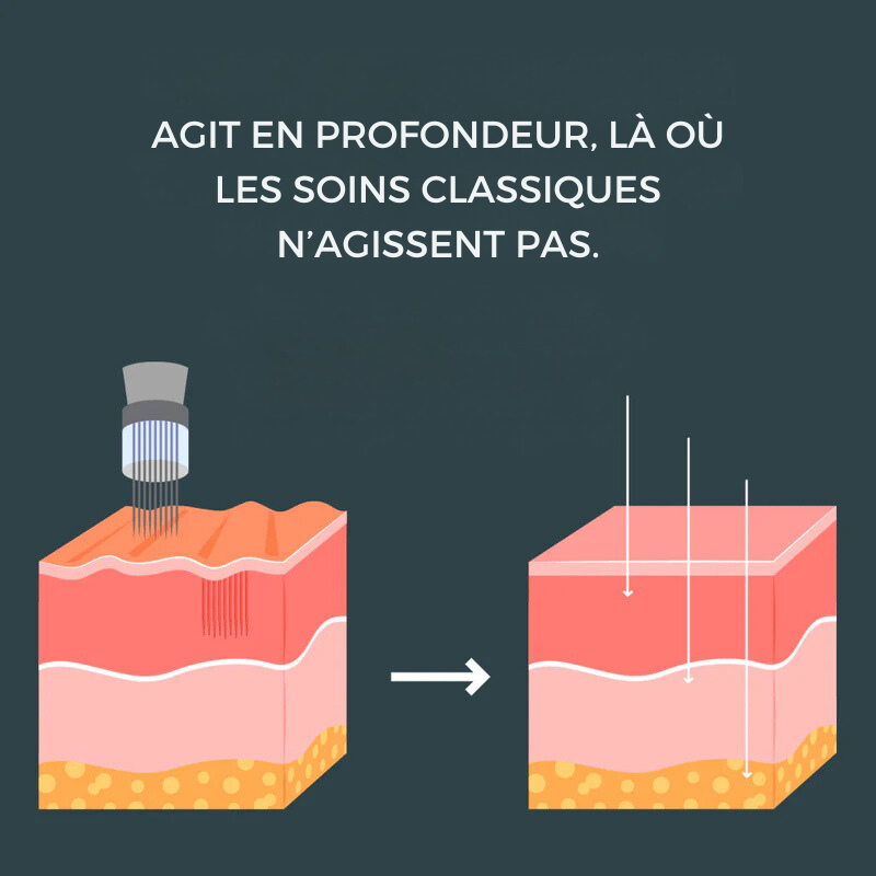 Micro Infusion anti-âge Lift Pro™