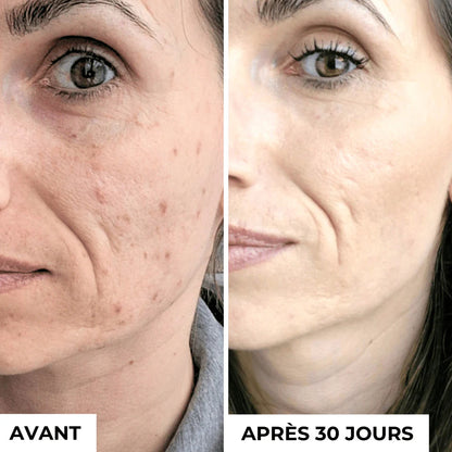 Sérum Niacinamide + Vitamine C Anti taches et acné