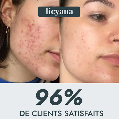 Sérum Niacinamide + Vitamine C Anti taches et acné